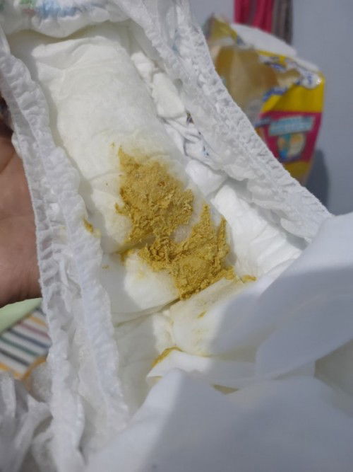 feses bayi kuning pucat ( maaf, jangan d lihat fotonya jika jijik )