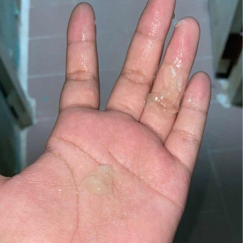 39+5w มีมูกใสๆออกมา ไม่มีอาการเจ็บท้อง แบบนี้ต้องไปโรงพยาบาลเลยไหมคะหรือว่าต้องรอมีน้ำเดิน