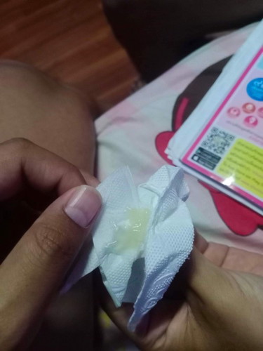 มีมูกไหลออกจากช่องคลอด