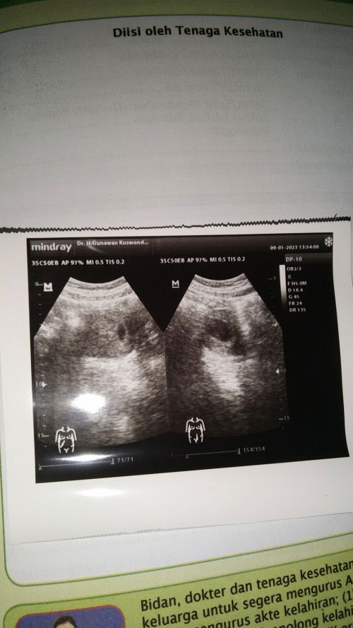 Uk 7w4d masih kantung