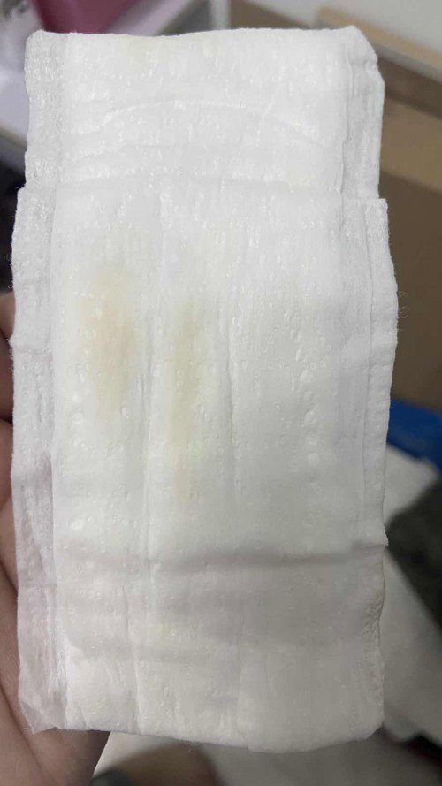 Keputihan kembali lagi selepas ubat insert 3 kali
