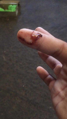 สอบถามแม่ๆตอนนี้ท้อง34วิคค่ะ