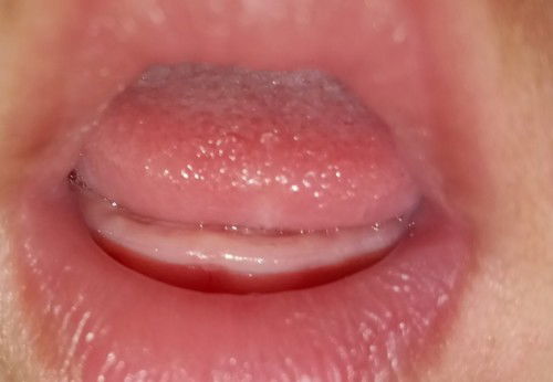 Apa ini sedang tumbuh gigi