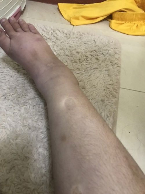 แบบนี้เป็นอะไรคะ