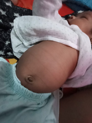 Normal lang po ba na ganto kalaki tyan ni baby? 1 month old n po s'ya