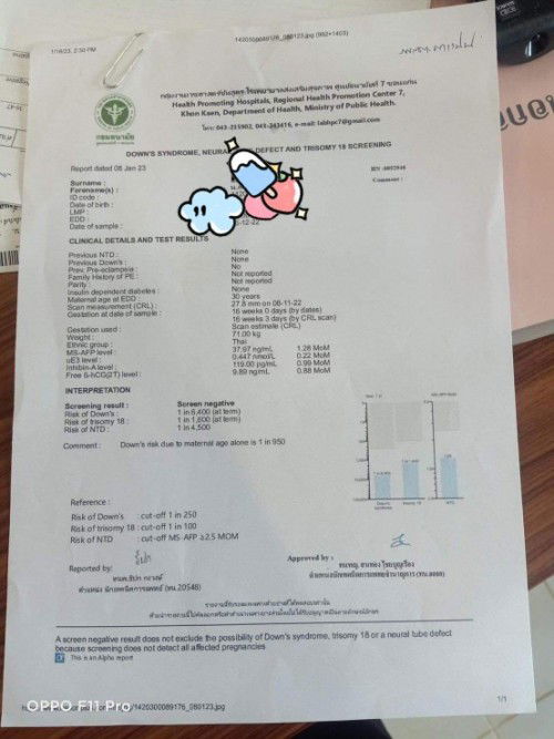 ผลตรวจดาวน์ซินโดรม