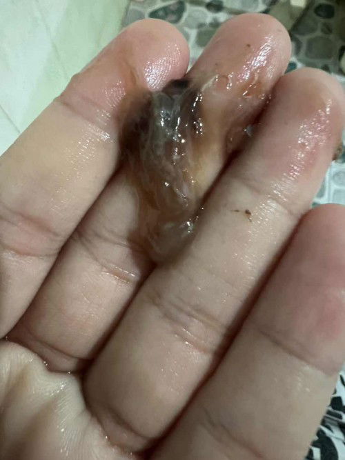 รบกวนสอบถามแม่ๆที่มีประสบการณ์คลอดหน่อยค่ะ