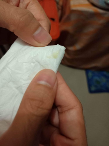 Hello Po mga Momshies, Tanong ko lang po If ok lang po ba yung gantong discharge wala naman po amoy