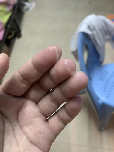 แม่ช่วยดูหน่อยค่ะ ว่าใช่มูกหรือว่า หรือตกขาวคะ