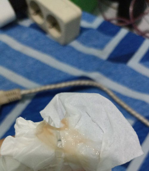 LENDIR DAN DARAH USIA HAMIL 19W