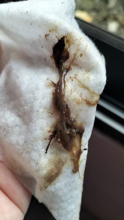 Normal discharge po ba kaya ito 39weeks preggy po