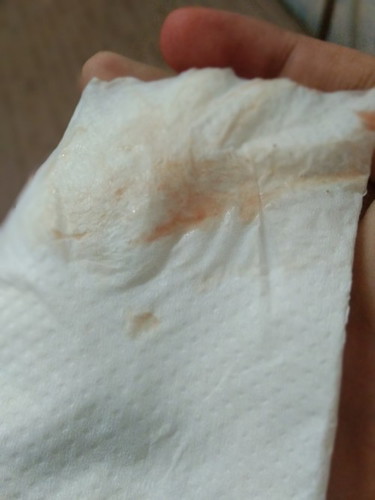 40+1 เเบบนี้ใช่มูกเลือดรึป่าวค่ะ