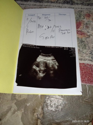 Jika terakhir haid bln November tgl 22.terus sekarang berapa ya mb" Usia kandungan nya.