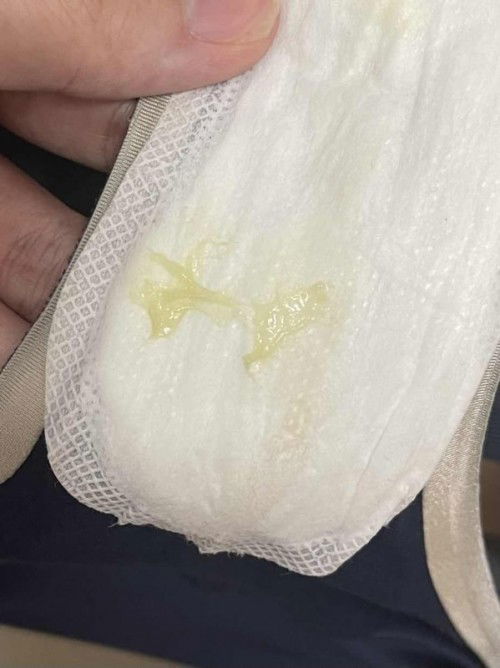 is this mucus plus?