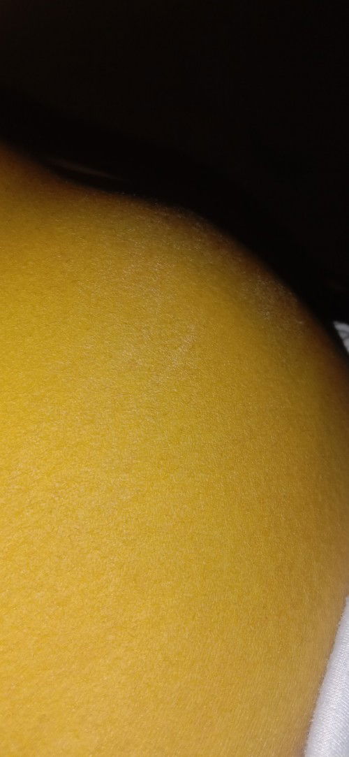 bunda disini ada gk seperti aku hamil 12wek kulit perut kering kaya gini rekomend dong buat lutionny