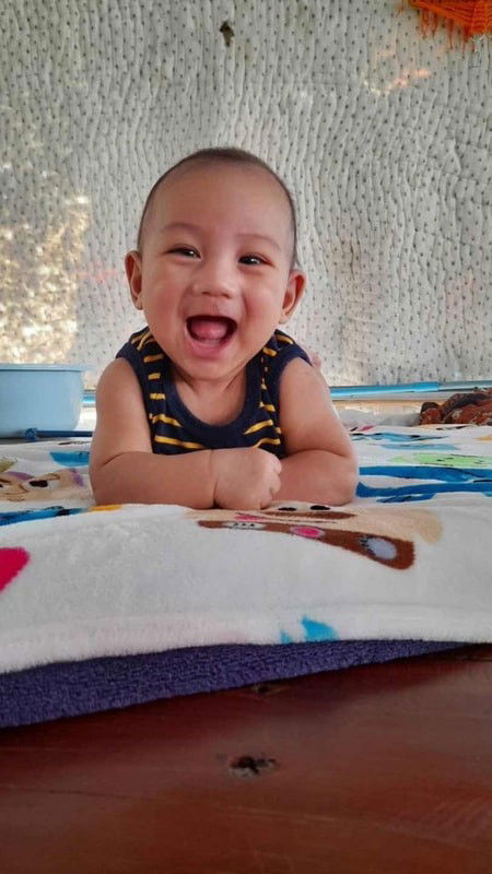 แชร์ประสบการณ์ลูกขลิบพังผืดใต้ลิ้น กับ รพ.รัฐฯ