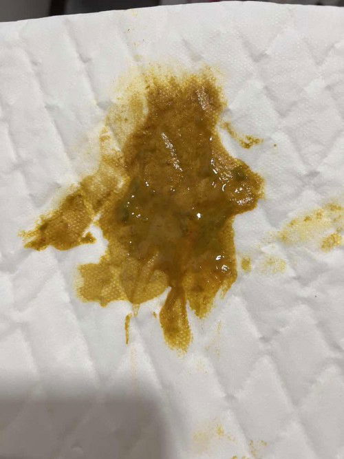 ลูกอึปนเลือด และมีกลิ่นคาว อึเป็นน้ำ มีมูกๆด้วยค่ะ