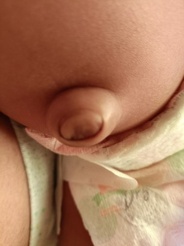 Pusod ni Baby