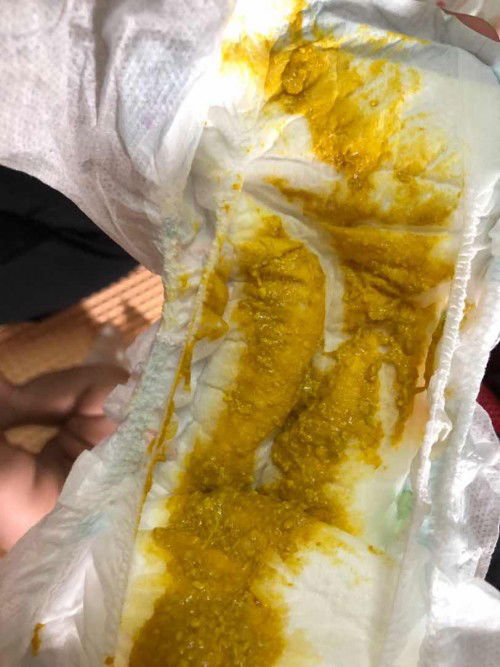 normal ke atau cirit birit?