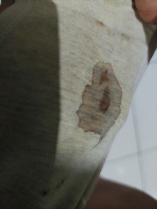 Udah 37w6d dan subuh gini ngerasa tiba2 kayak ada yg keluar ternyata diliat kayak air / flek gini