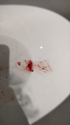 Implantation Bleeding or Menstruation?