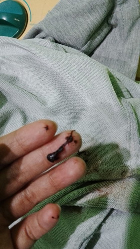 ada yang pernah gini juga dan masih bisa selamat janinnya?