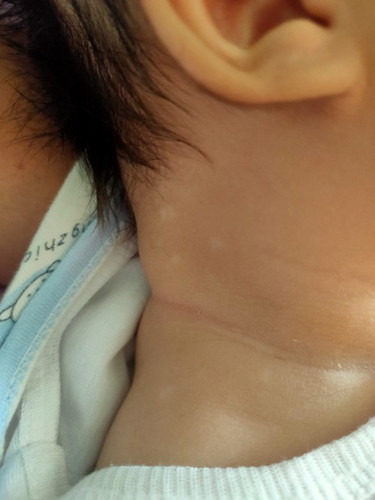 Skin pigment