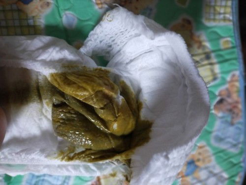 Green poop