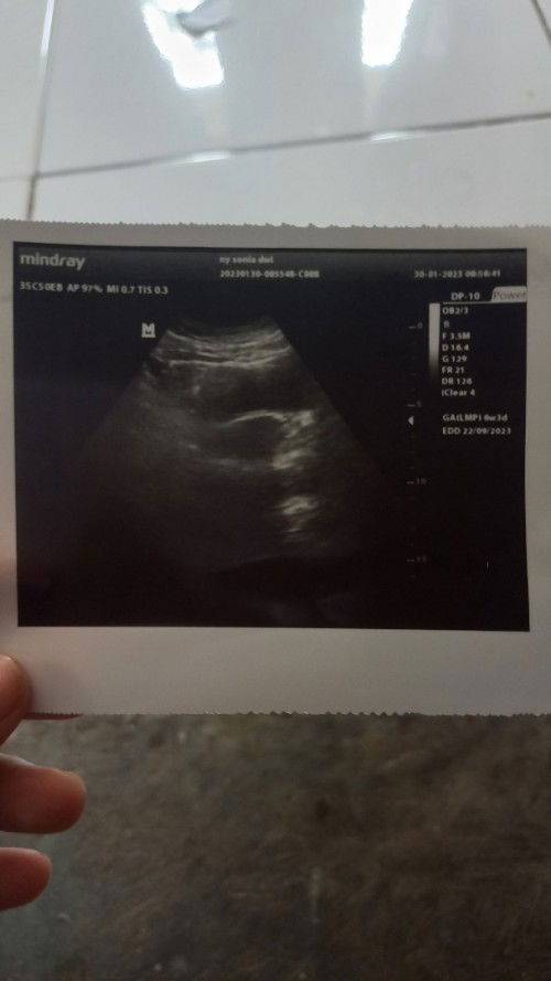 Uk 6w tapi masih penebalan dinding rahim normal gak sih bun ?