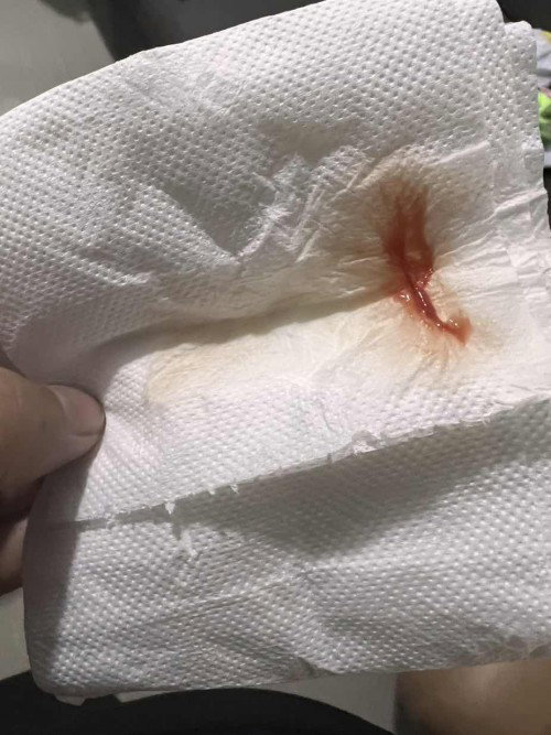 Mucus plug po ba ito ? Please help.. need ko na po ba pumunta hospital?