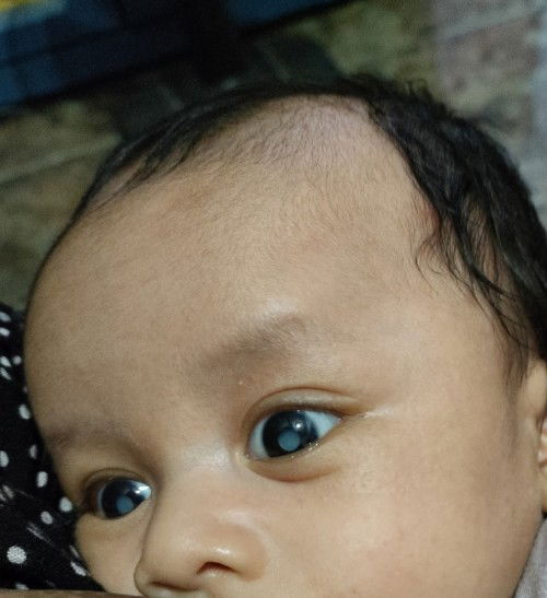 Rubella & Toxoplasma