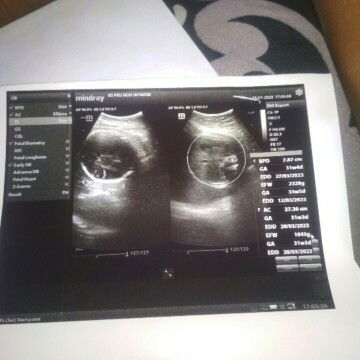 Hasil usg ini maksudnya gmn ya bun yg bisa baca hasil usg