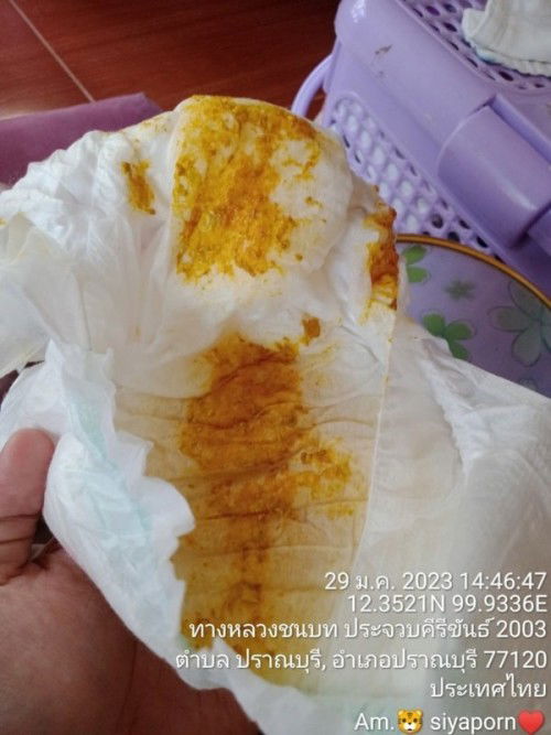 แบบนี้น้องถ่ายเป็นมูกเลือดหรือป่าวค่ะ