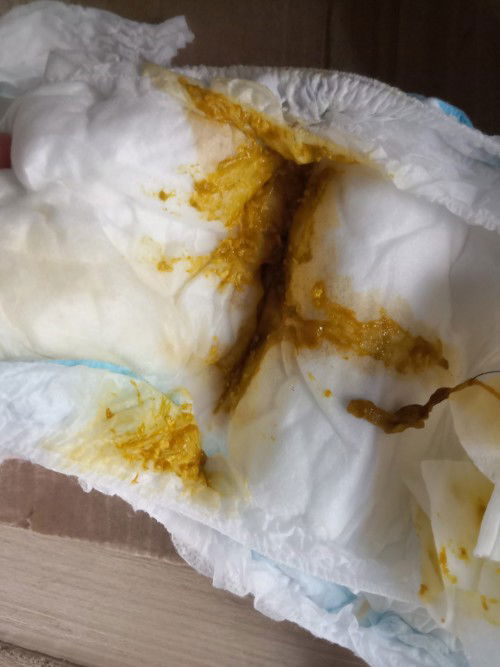 Normal lang puba ito o hinde