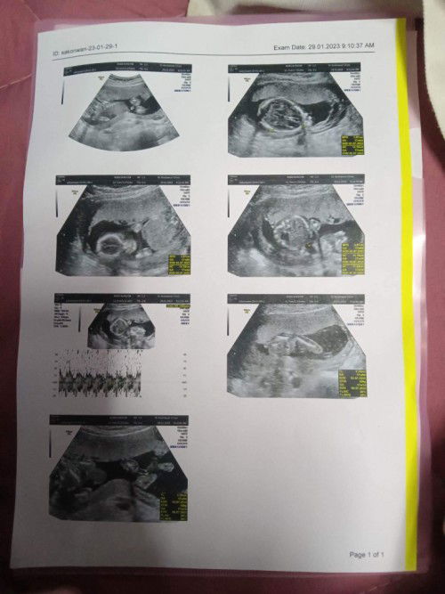 17วีค4วัน ซาวด์ เห็นแบบนี้