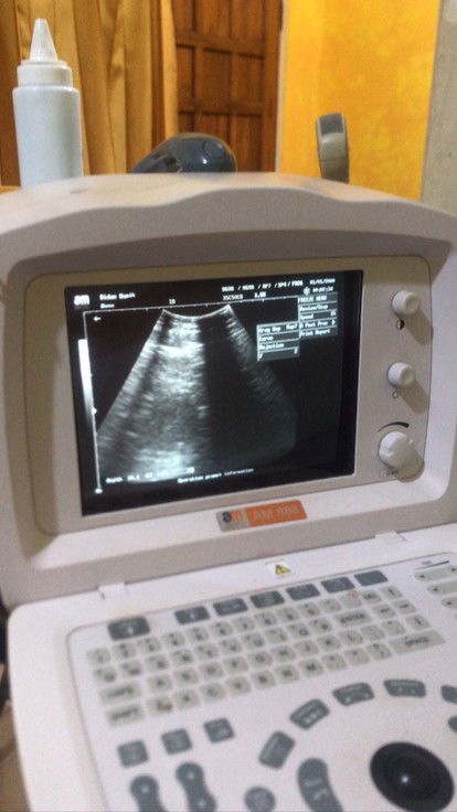 usg bantu jawab bun🥺