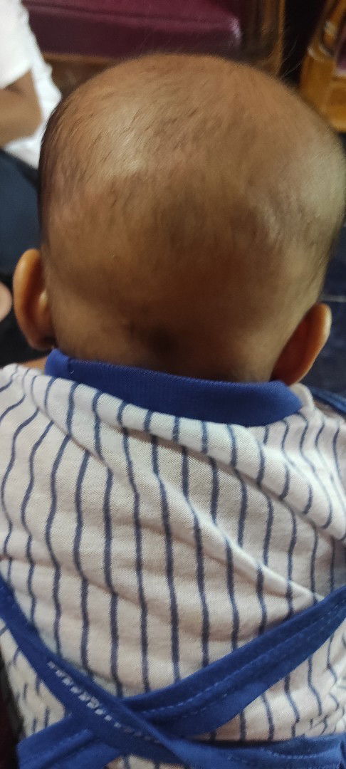 Tulang tengkorak bayi 3bulan