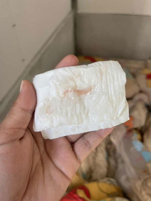 แม่ๆคะ 39+4 แบบนี้ใช่มูกเลือดรึป่าวคะ แต่ยังไม่มีอาการได ๆ ค่ะ นอกจากท้องปั้นธรรมดา แต่ปวดหน่วง ปวดขาหนีบ