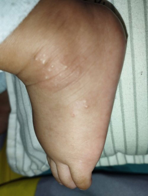 Ini ruam atau apa ya?