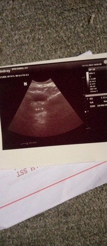 Hasil USG 5 w