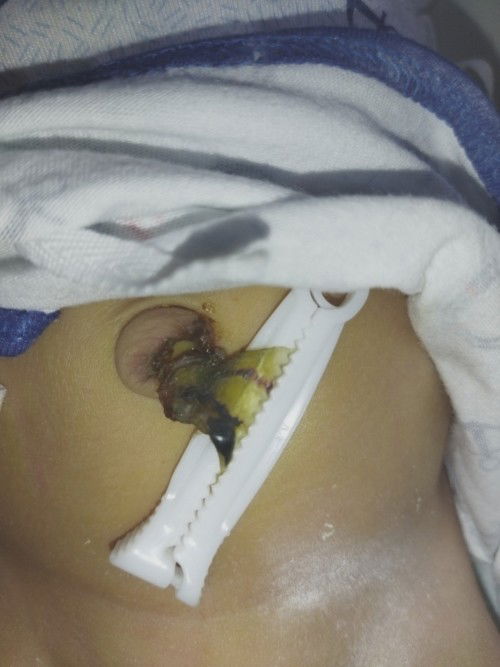 Is it Normal lang po ba???