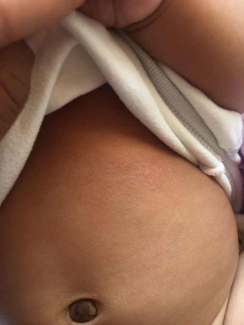 สอบถามแม่ๆค่ะ