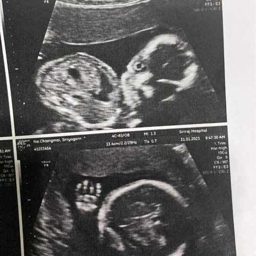 อัลตร้าซาววันนี้19wk6d