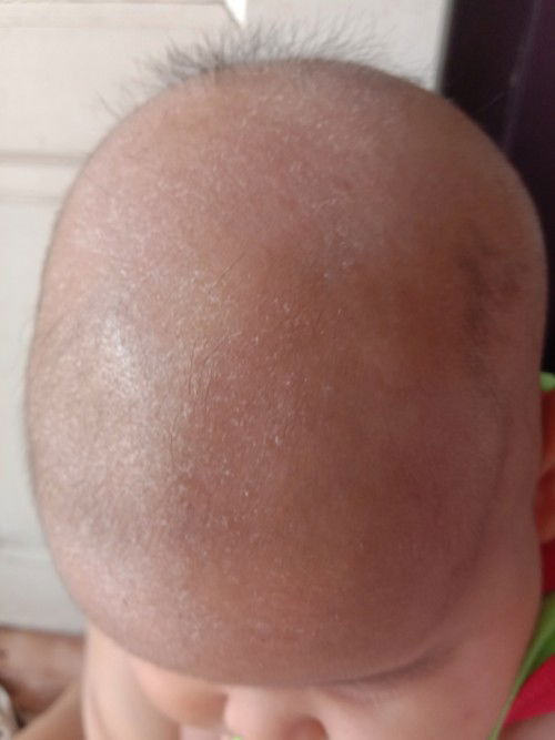 แบบเปนอันตรายมั้ยคะ