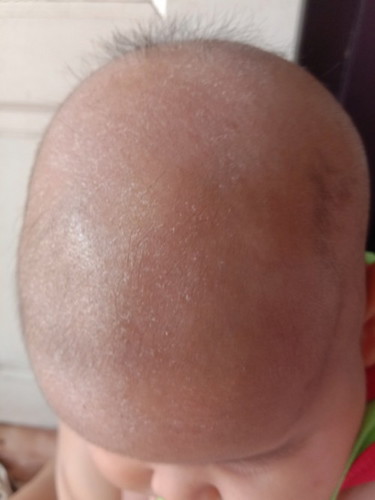 แบบเปนอันตรายมั้ยคะ