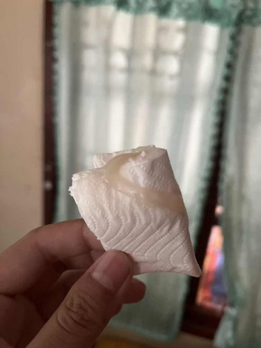 ใกล้หรือยังคะ ควรไป รพ เลยไหม หรือรอก่อน