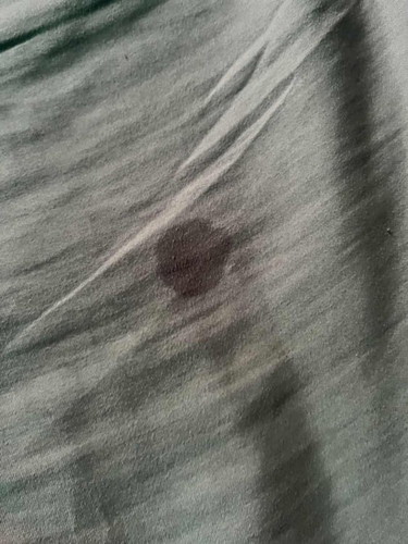 leaking air ketuban