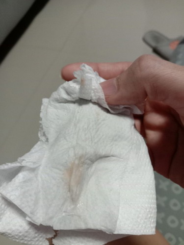 แบบนี้เรียกว่ามูกมั๊ยคะ