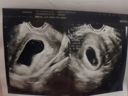 บ้านไหนเป็นบ้างคะ