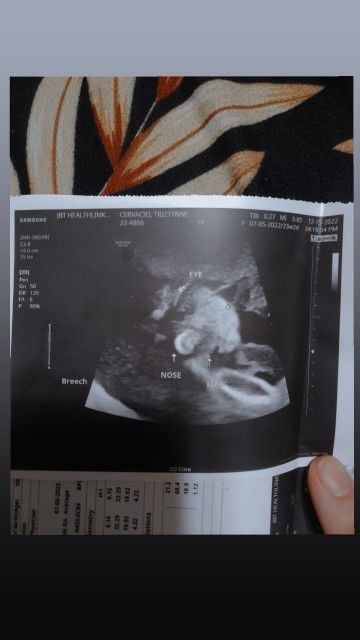 Mga mami ano po ibig sabihin nito